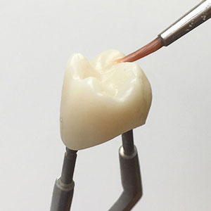 Подкраска + нанесение глазури на коронку